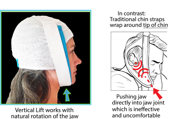 Knightsbridge-Dual-Band-Chin-Strap-cpap-store-usa-4